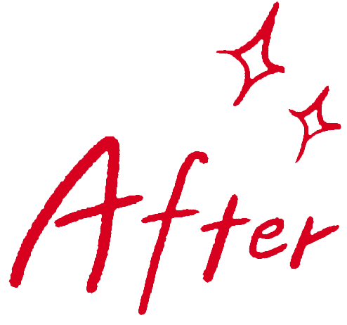 afterアイコン